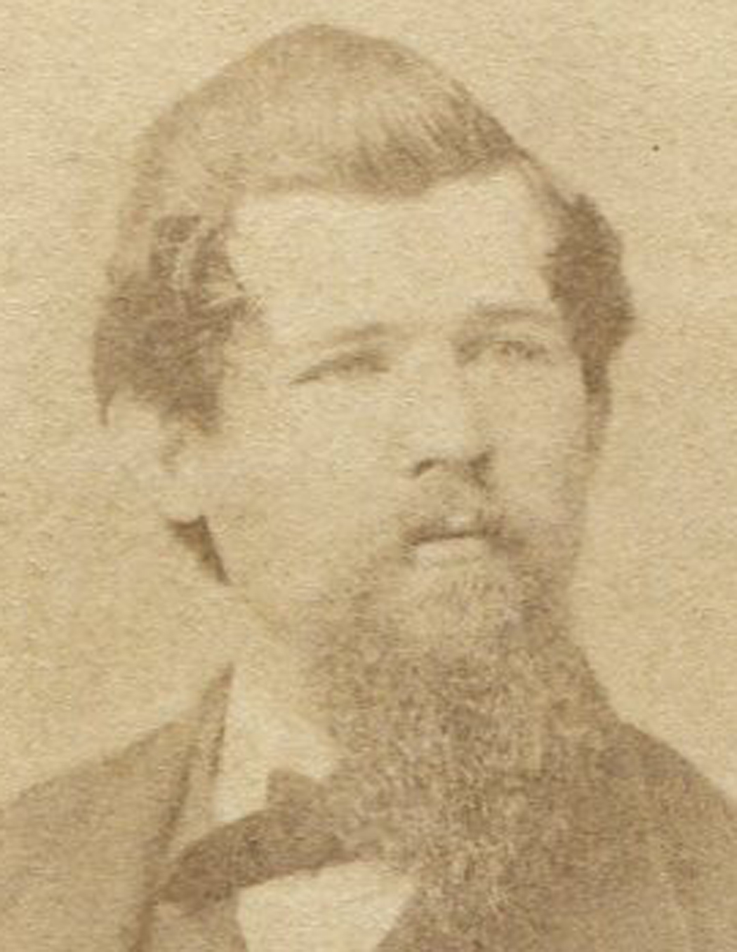 Man With Sad Eyes And Thick Slicked Back Hair Cdv By Gardner