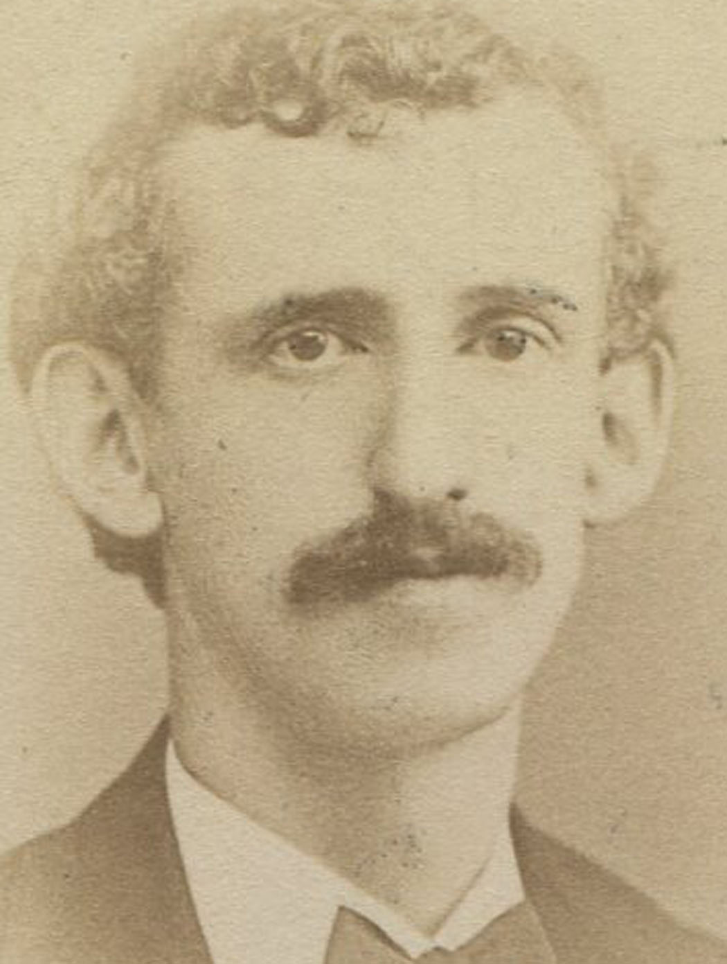 Man With Curly Hair And Very Big Ears Cdv Springfield Mass Ebay